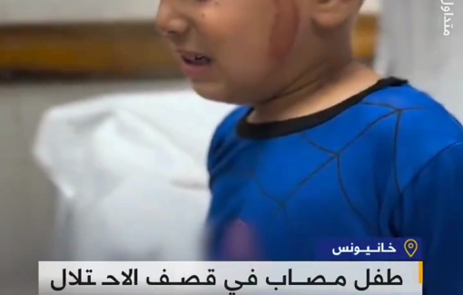 Thumbnail preview image for the video titled: Child injured in Israeli attack on a displacement tent in Khan Younis