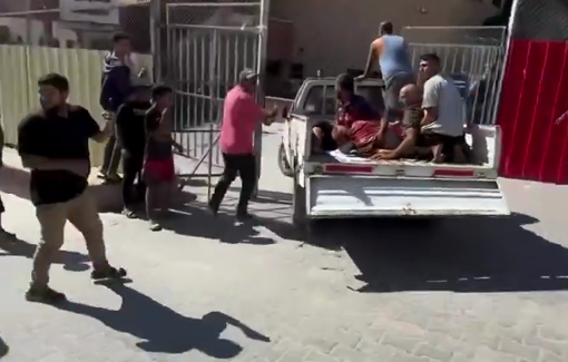 Thumbnail preview image for the video titled: Injuries from Israeli airstrikes arrive at Nasser hospital