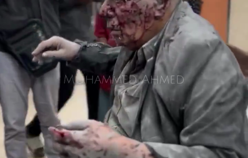 Thumbnail preview image for the video titled: Elderly injured in IDF bombing of Maghazi Services Club