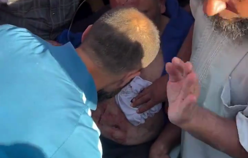 Thumbnail preview image for the video titled: Injured father mourns his son killed in the same massacre in Maghazi