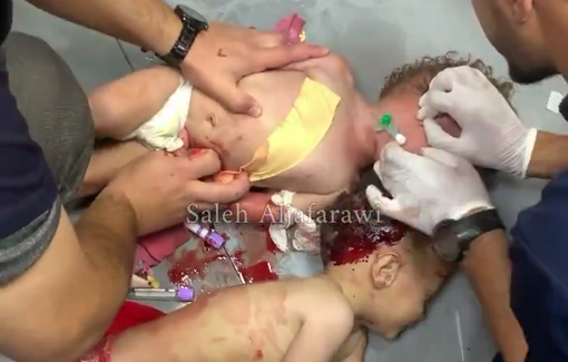 Thumbnail preview image for the video titled: 388 days of Israel harming babies