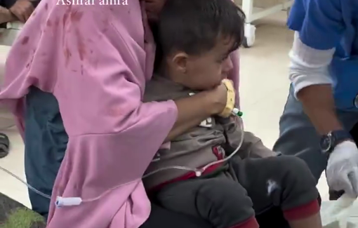 Thumbnail preview image for the video titled: Children injured in midnight strike on a tent west of Deir al-Balah