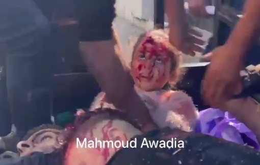 Thumbnail preview image for the video titled: Little child injured in Israeli strike on a public gathering in Gaza City