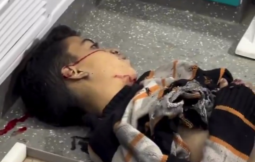 Thumbnail preview image for the video titled: Child gruesomely killed by Israeli strike in Bureij