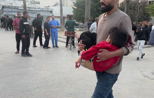 Thumbnail preview image for the video titled: Injured child carried to hospital following Israeli strike on market