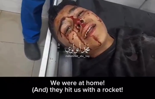 Thumbnail preview image for the video titled: Child injured by Israeli strike on his home