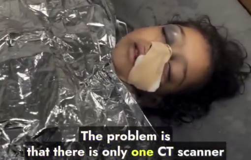 Thumbnail preview image for the video titled: Only one functioning CT scanner in northern Gaza