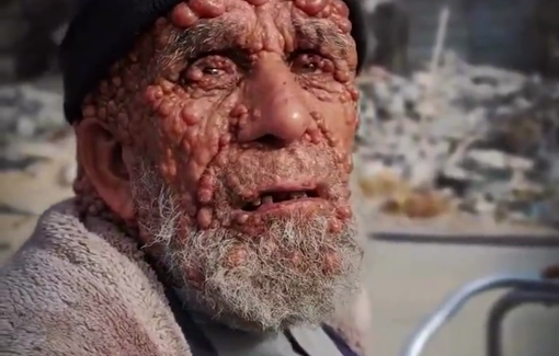 Thumbnail preview image for the video titled: Ailing elderly Abu Saber left without home nor treatment