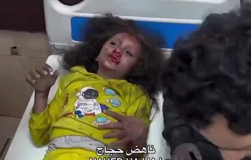 Thumbnail preview image for the video titled: Children injured by Israeli strikes in Bureij